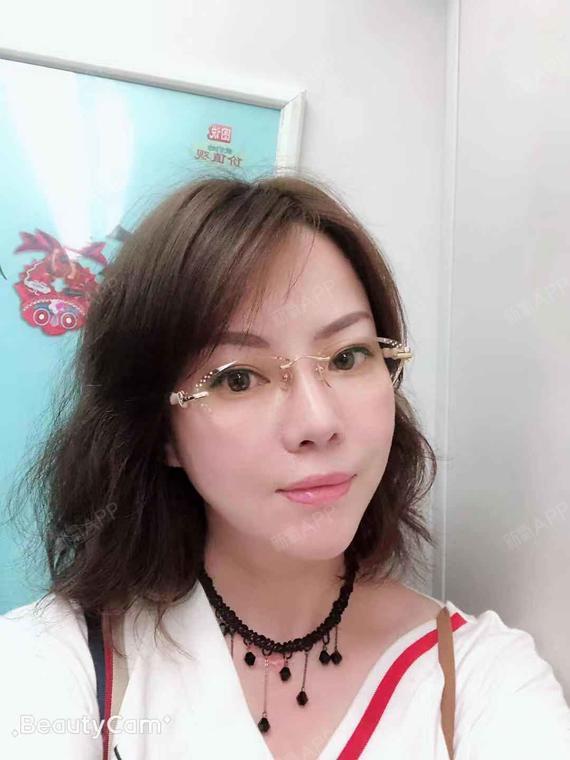 氧气3459221527852020埋线辟谷第98天美丽痘痘吃提升会长吗餐脸上图片