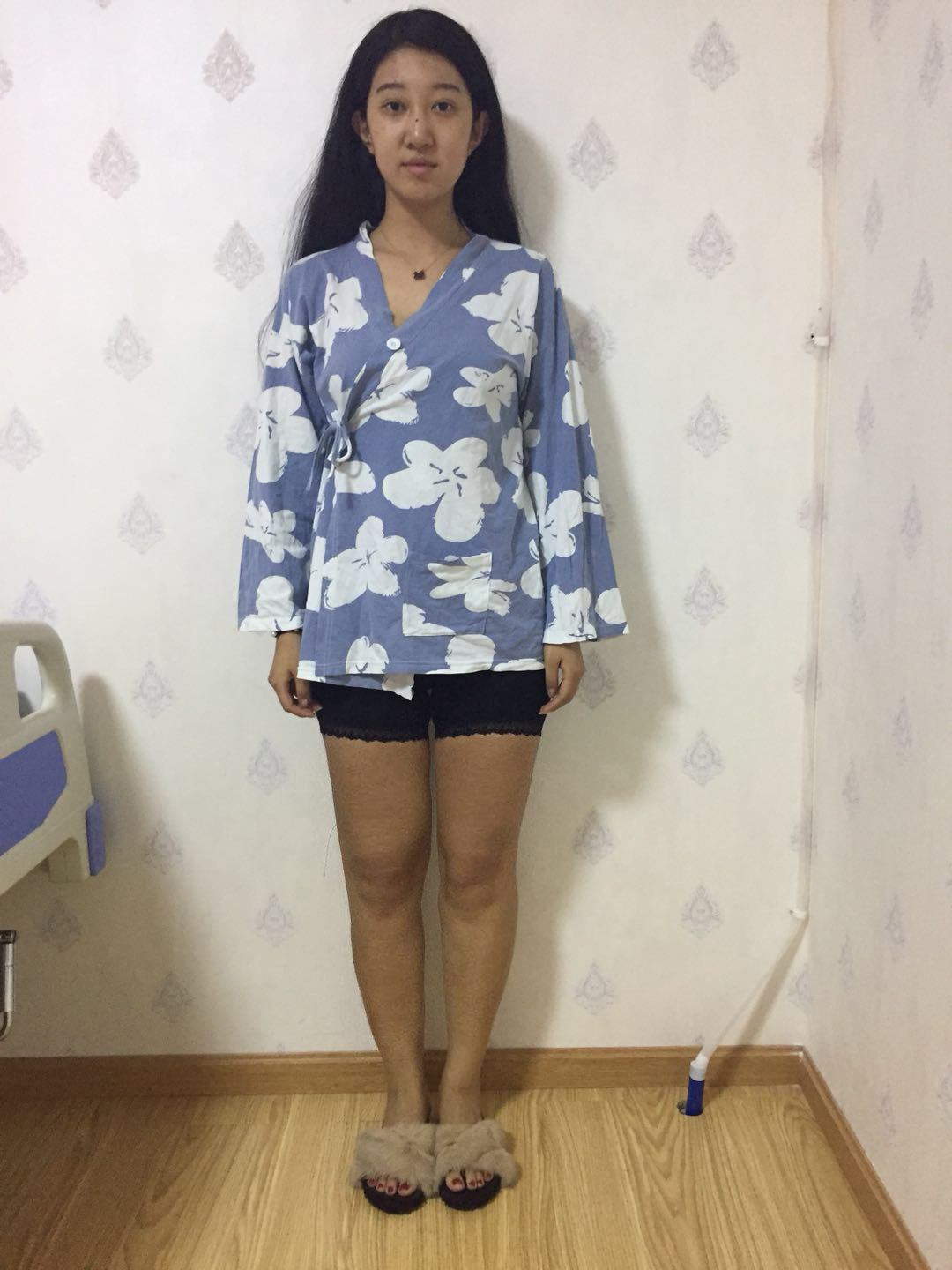 匹诺曹不说谎的美丽日记"7.21"吸脂瘦大腿