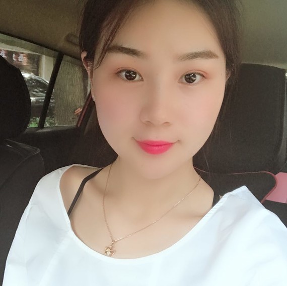 【长沙健丽-不开刀双眼皮】开内眼角的功效:缩