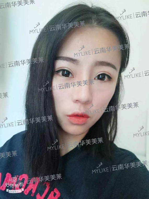 【真人出镜】三位不同脸型的小仙女谁能把鼻子隆出新