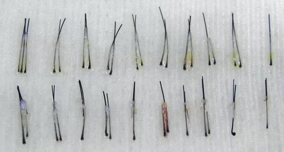 植发从后枕部提取毛囊，那后面会秃吗?今天遇到一个发友来问，植发提取后枕部_圈子-新氧美容整形