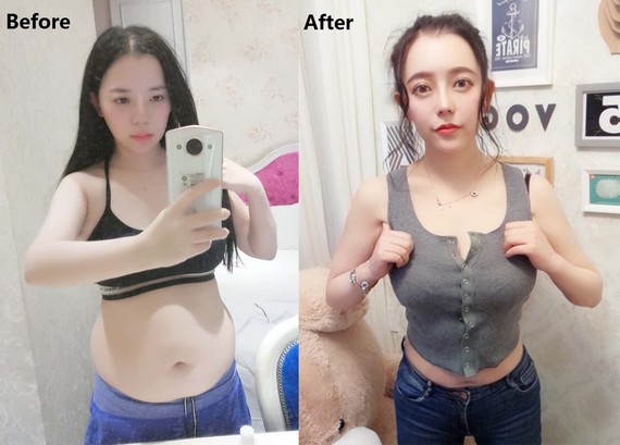 新氧 - 氧气姐 | 北京同城 | 整形纯干货 | 氧姐科普 | 你想知道的医美知识都在这 | 真人案例 | 医美整形 | 干货科普 新氧 - 氧气姐 | 北京同城 | 整形纯干货 | 氧姐科普 | 你想知道的医美知识都在这 | 真人案例 | 医美整形 | 干货科普