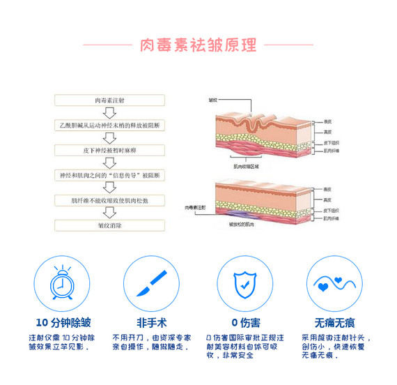 肉毒毒素为什么能除皱纹?