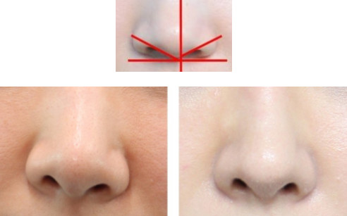 主要是从鼻子的中心线和鼻翼那个角度有差异,欧尼这么详细写出来面部
