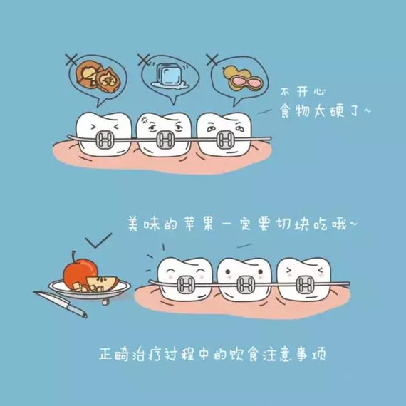 正畸小科普——看图学知识!