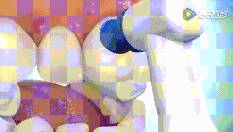 那就是隐形牙套;还有人夸张的认为牙套是在牙齿上钻一个洞固定上去的
