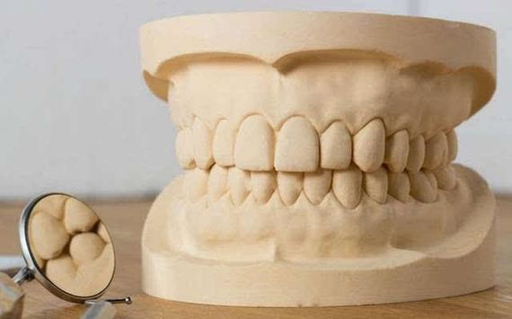 什么样的牙齿适合做牙贴面美白?牙贴面的存在