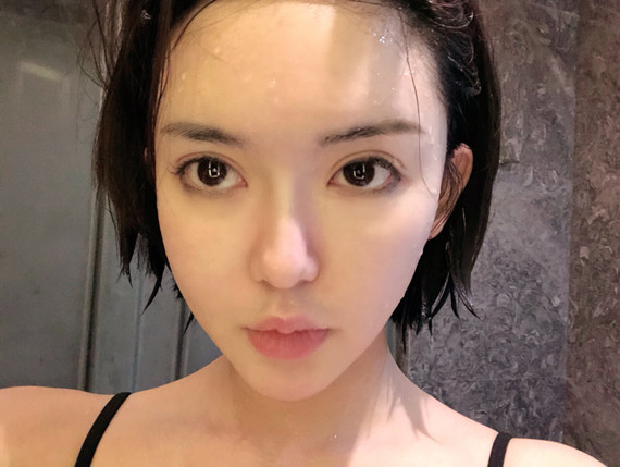 全脸线雕+线雕隆鼻术后恢复一个月我是今年8