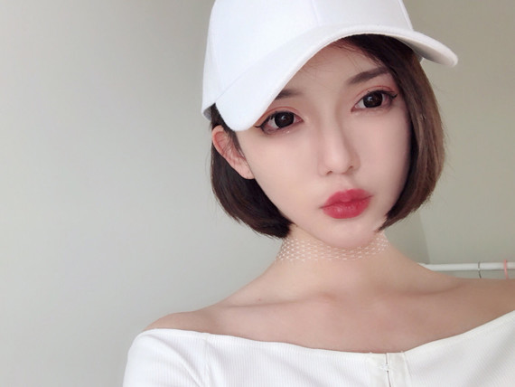 全脸线雕+线雕隆鼻术后恢复一个月我是今年8