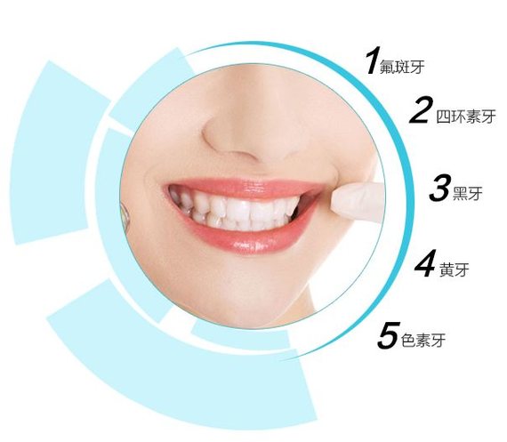 做牙齿贴面会让嘴变凸?假的!唇红齿白、朱唇皓齿、齿如含贝……国人爱美，对_圈子-新氧美容整形