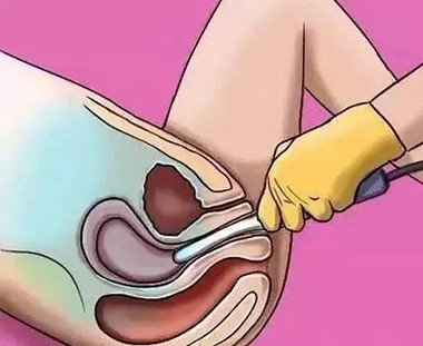 【妇科检查】妇科体检项目怎么选?看这里!
