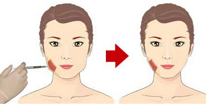瘦脸有道,脸型决定怎么瘦瘦瘦咬肌肥大型者一