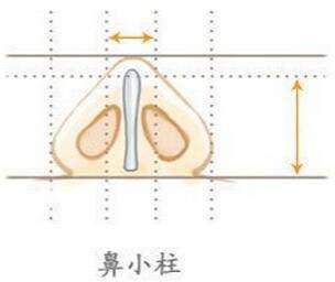 为什么要进行鼻小柱整形?