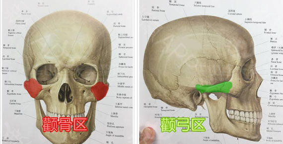 脸型不好看,到底是颧骨问题还是颧弓问题?