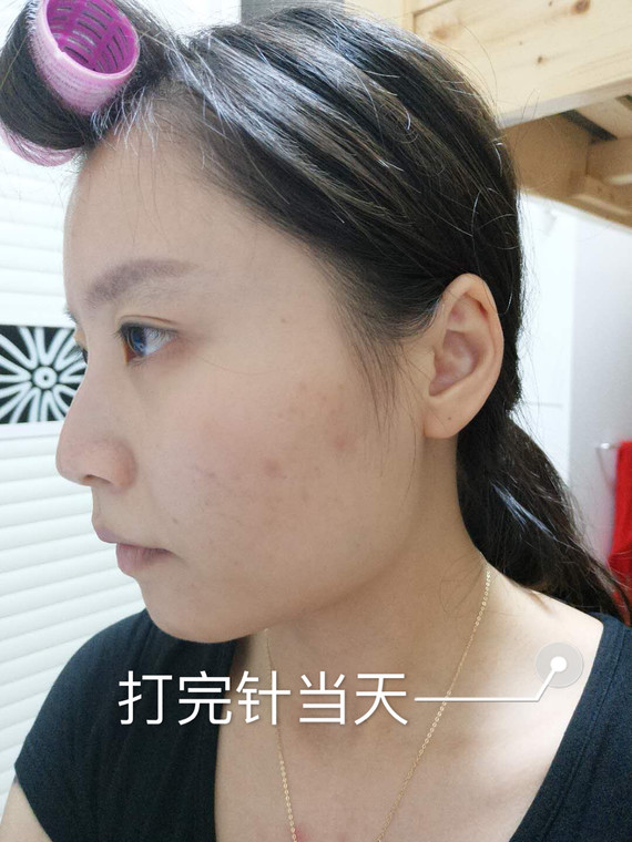微塑身|术后当自强|国内整形|广州同城|昆明同城|减肥笔韵之美身体整形图片