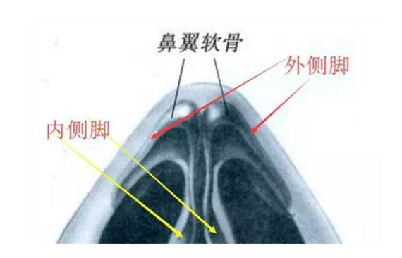 3, 鼻中隔软骨/耳软骨移植支撑法