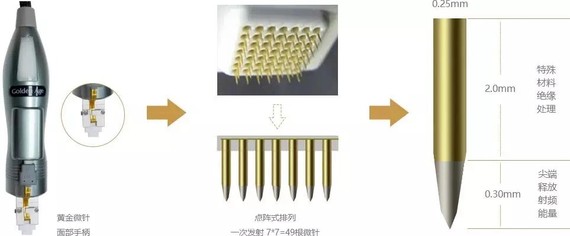 肥胖纹能不能通过做手术去掉呢?你有没有肥胖