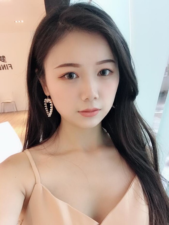 切开双眼皮术后的疤痕很明显吗?