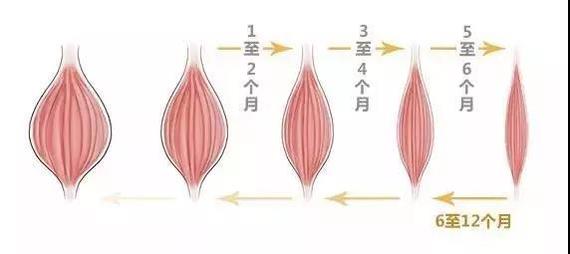 除皱针去除动态皱纹效果最佳 除皱针除皱的原理 其实是通过注射肉毒素