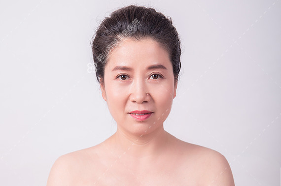 那哪些眼部的问题需要眉眼部综合提升手术?眼