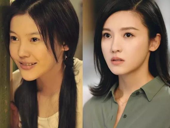 杨子姗|廋了就会有法令纹吗?
