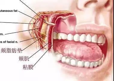 关于去夹脂垫你知道多少?瓜子脸一直美丽脸型