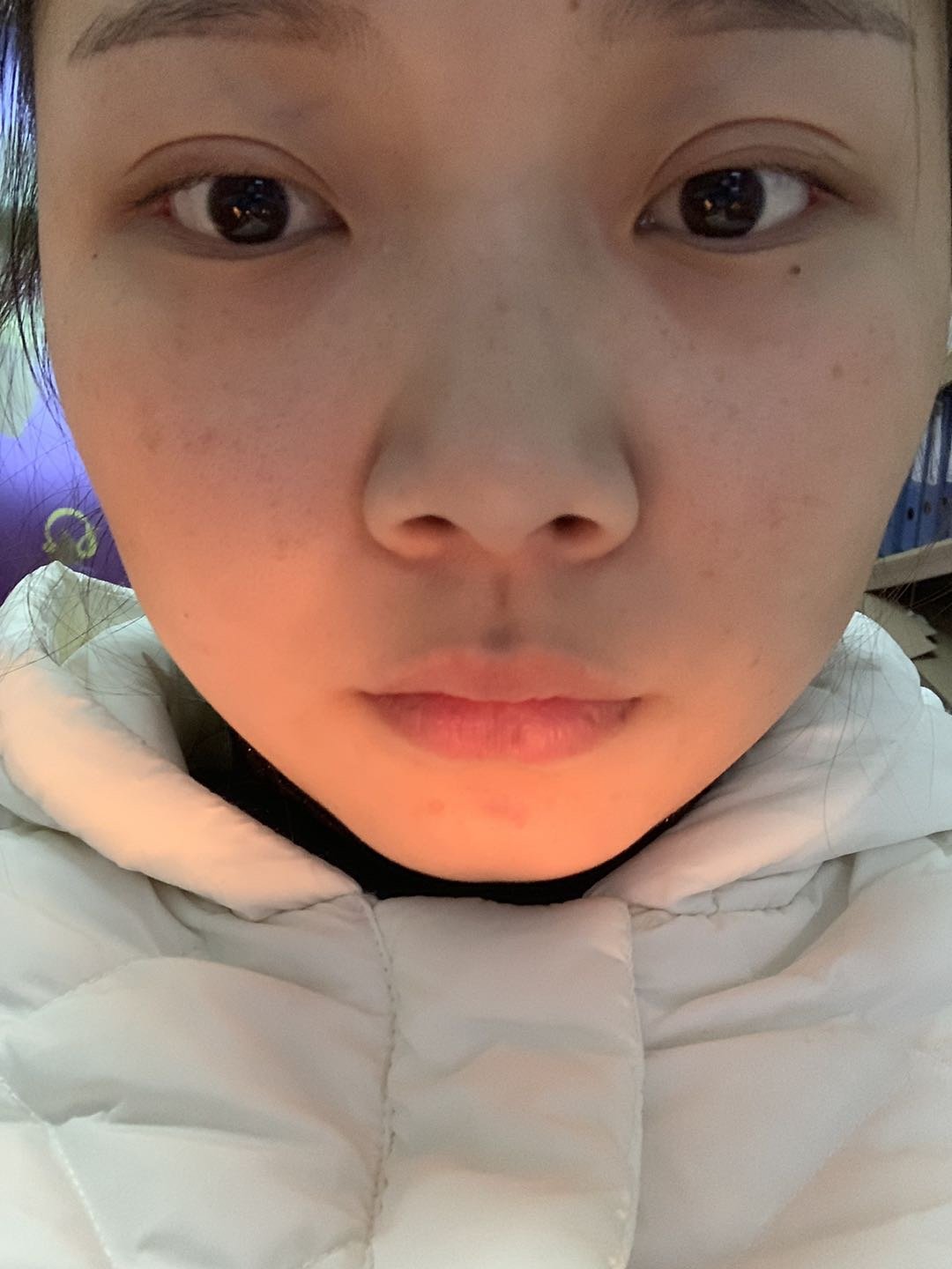 怎样微调能使鼻子鼻头看过去精致一点有点朝天鼻我气!鼻孔还很大!