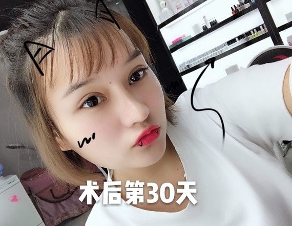 武汉妲医疗美容(原武汉美天)美丽美女日记人找v美女图片