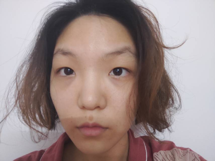 戴眼镜才不觉得眼距那么宽