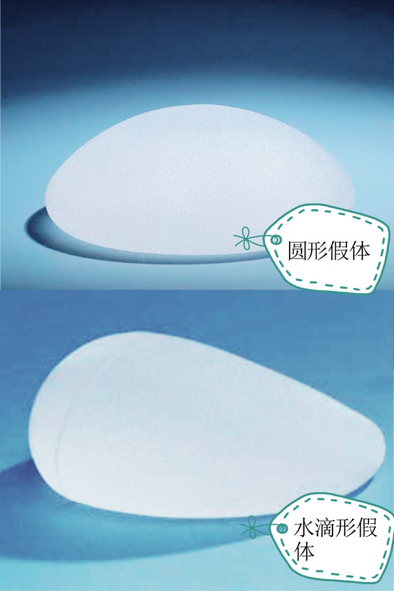 假体隆胸