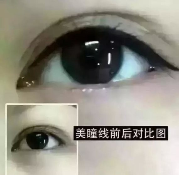 为什么要纹美瞳线?美瞳线疼吗?