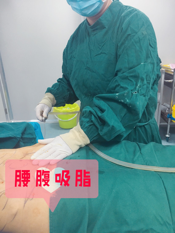 不过,腹部吸脂手术安全吗?