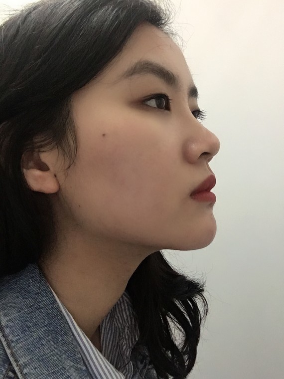 为"难嫁风"的自己而骄傲# 为什么侧脸还能看,正脸却一塌糊涂