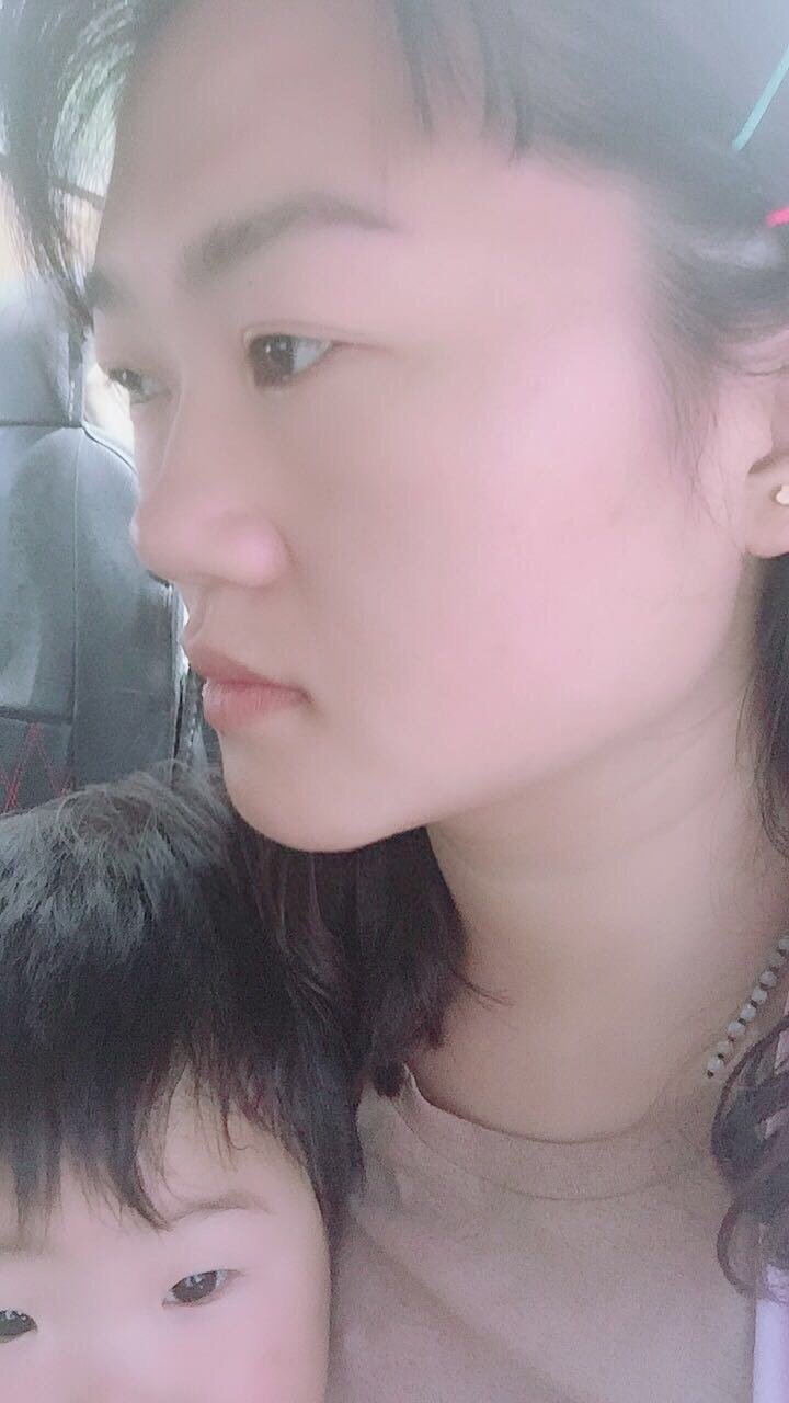 一直羡慕别人的侧面的流畅线条可惜我的脸腮帮子的肉很_圈子-新氧美容