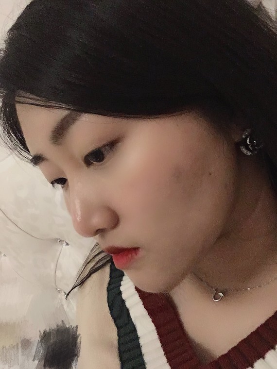 地包天十几岁的时候错过了整牙的年纪结果现在