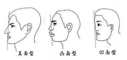 按照不同的类型,侧面分为直面型,凸面型,凹面型这三类.