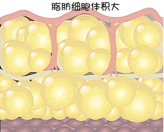 而运动减肥的原理是减少脂肪细胞的体积