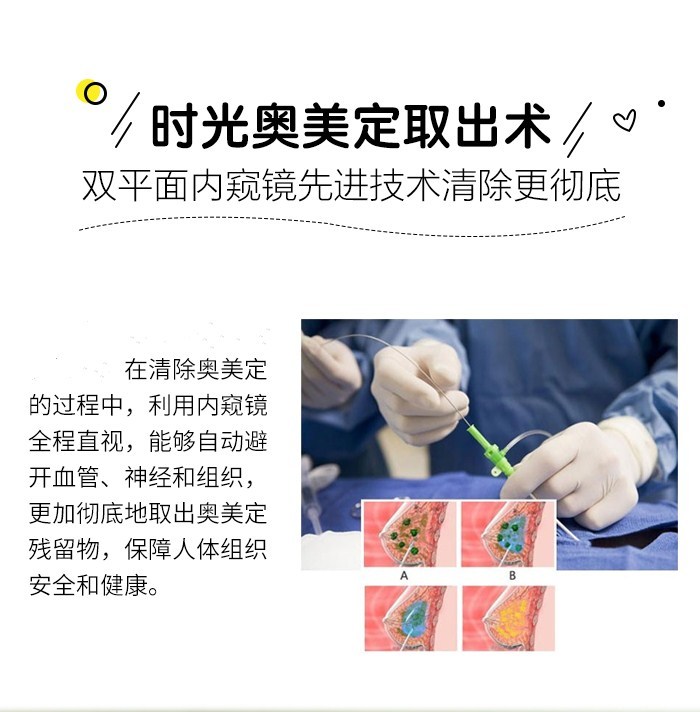 ada移动的"胸"名为英捷尔法勒,俗称奥美定,学名聚丙烯酰胺水凝胶,是