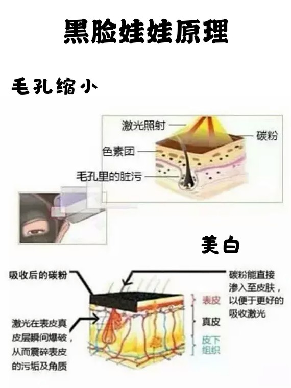 黑脸娃娃,有一种黑能让你极致白!