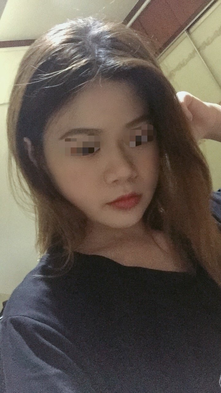 本人女,22岁,混干皮,之前敏感痘肌,做过光子嫩肤,剥脱点阵激光,水光