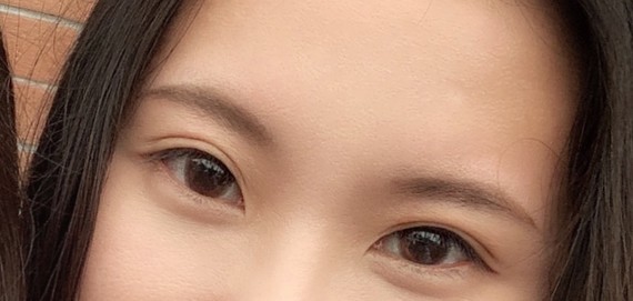 晒出你的东方媚眼式双眼皮