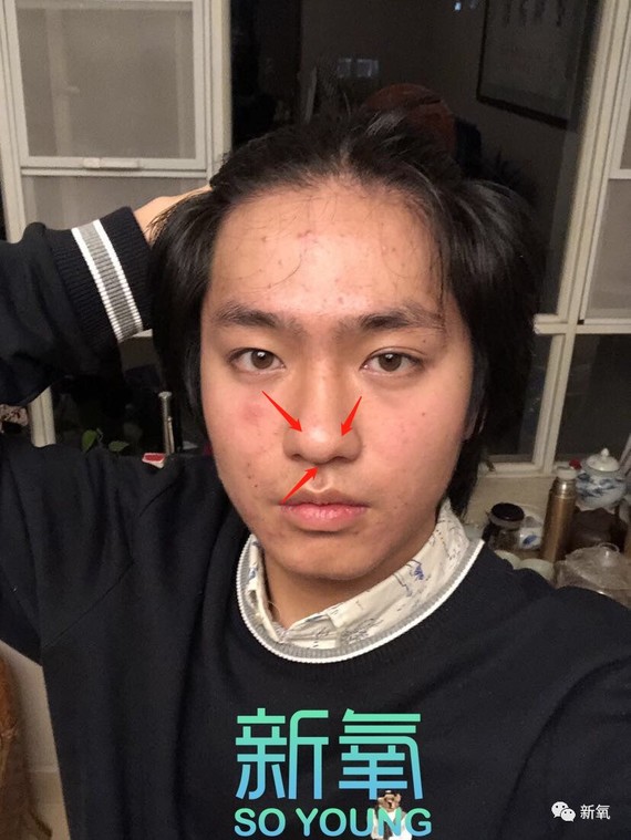 对比意向脸们的正面,鼻头有肉,海鸥线清晰,鼻翼和鼻头之间的沟也肥肠