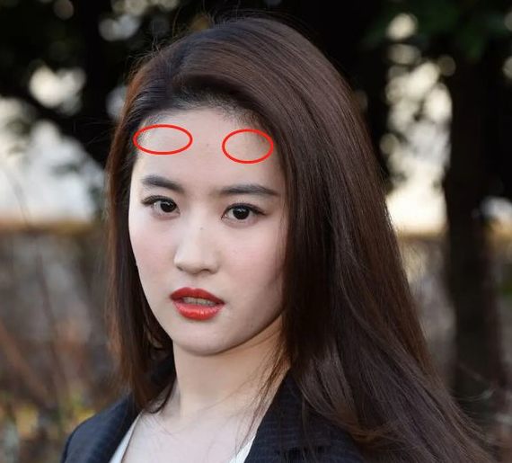 (面相学里的"日月角") 以刘亦菲为例,额结节在正面靠上的左右两侧