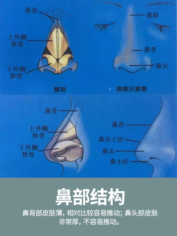 此前,我不知道强调多少遍:"鼻背可以动多次手术,但鼻头最多只能动三