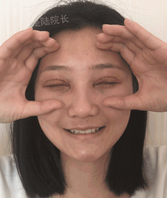 【双眼皮开眼角30天全记录】一个97年姑娘30天的焦虑与期待