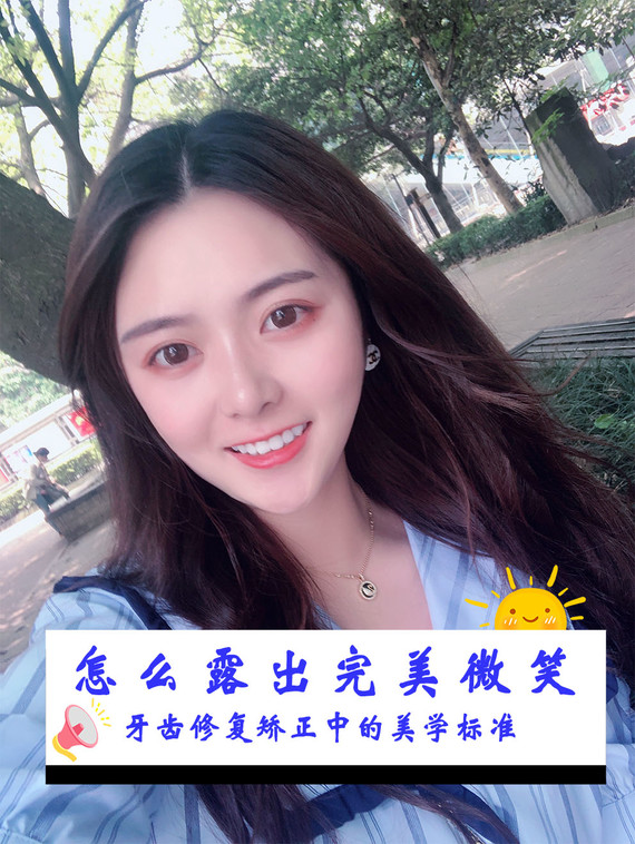 微笑线 中线 e线 颌平面等都是牙齿修复矫正中的美_圈子-新氧美容整形