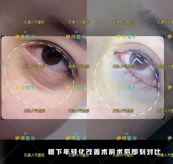 圈子-新氧美容整形