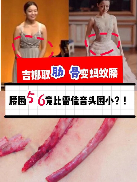 "真人芭比"吉娜腰56cm,为瘦不惜取了肋骨?