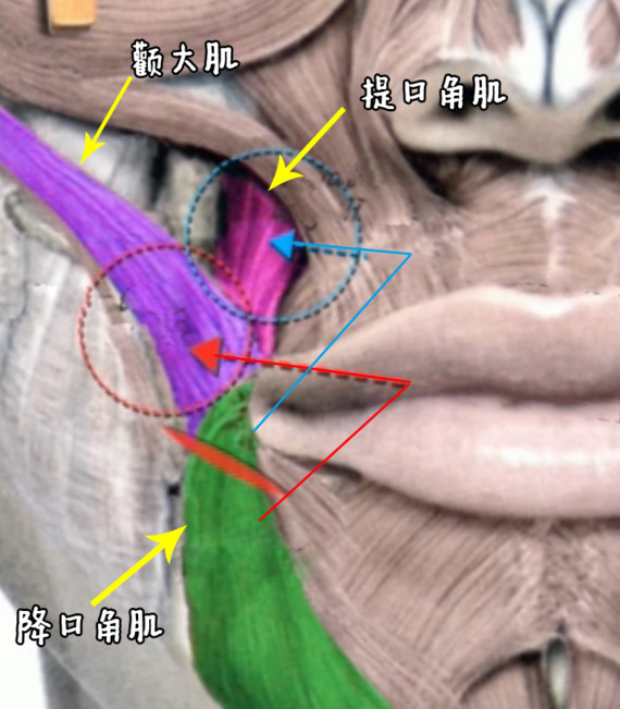 其次,离断口角下方的降口角肌,将断开的肌肉上边部分与提口角肌缝合