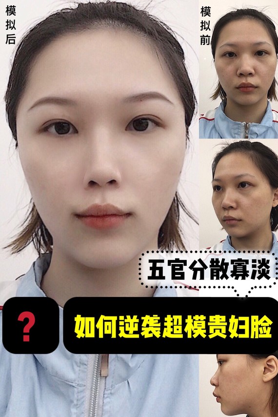 晓波看脸|五官分散寡淡该如何自救?调整后逆袭超模贵气脸!